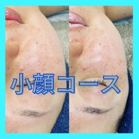 画像305